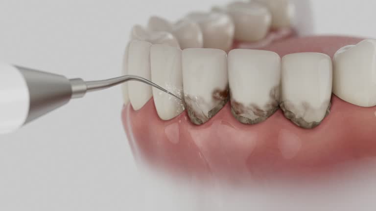 Trusted Tooth Extraction service in Priest River, ID - Dentist Open Now